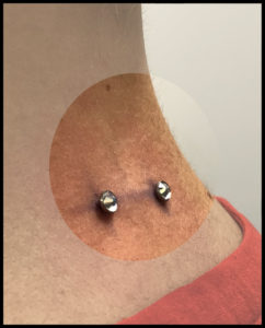 Piercing superficial Mandragora